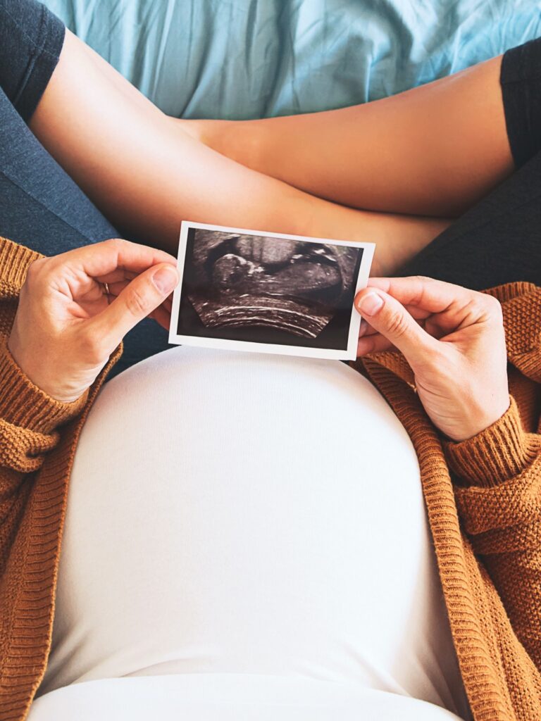 ultrasound printing image